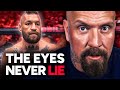 30 Million Reasons Conor McGregor Would Hide His Injury
