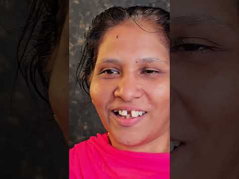 എല്ലാ പല്ലും പോയോ? ഇനി എന്ത് ചെയ്യും? #palludoctor #dentalclinic #smiledesigndental #dentalcare