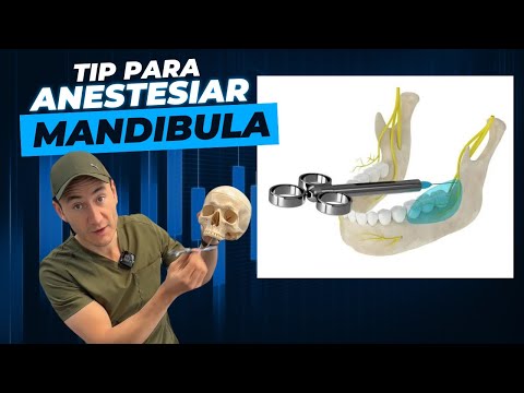 Great hack to numb the mandible