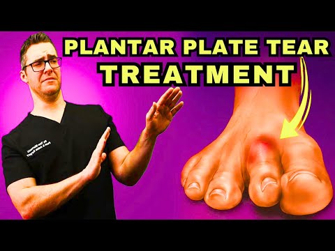 BEST 25 Plantar Fasciitis HOME Treatments Massage Stretches Shoes