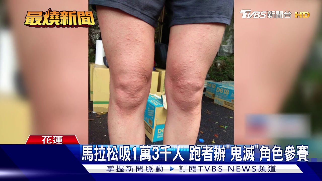 好痛!太魯閣馬拉松 12名跑者遭虎頭蜂螫