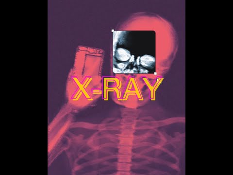 🎵LOQIEMEAN x SIDxRAM TYPE BEAT - X-RAY (prod. Michael One)