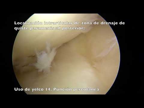 Medicamentos para el dolor en los músculos y articulaciones El dolor del cuello hacia abajo la parte de atrás