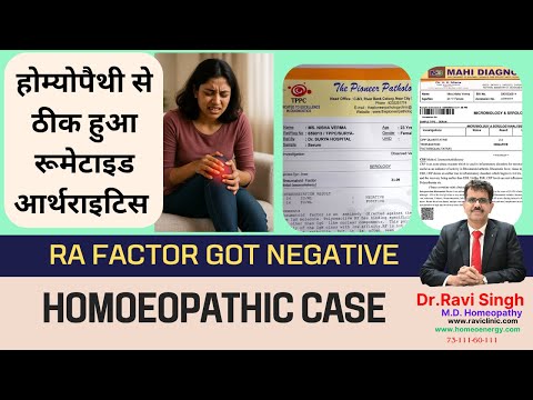 Cure of Rheumatoid Arthritis RA factor becomes Negative