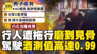 [問卦] 酒駕拖行 磨肉見骨 怎麼自救