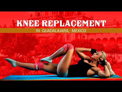 Get Suitable Package for Knee Replacement in Guadalajara, Mexico