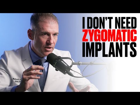 Ich brauche definitiv keine Jochbein- oder Flügelbeinimplantate in meiner Praxis.