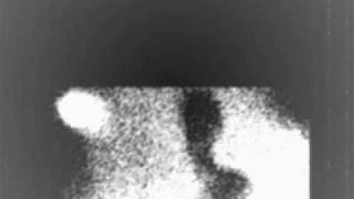 Red Lorry Yellow Lorry - strange dream