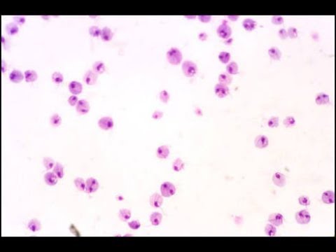 Die inneren Organe der Prostata Prostatitis und Nierenschmerzen