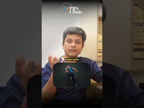 Myths about Plastic Surgery