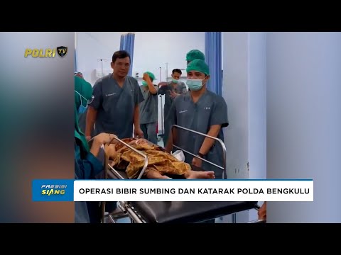 POLDA BENGKULU GELAR KEGIATAN SOSIAL OPERASI BIBIR SUMBING DAN OPERASI KATARAK GRATIS