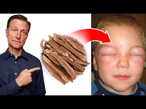 Shingles Natural Relief