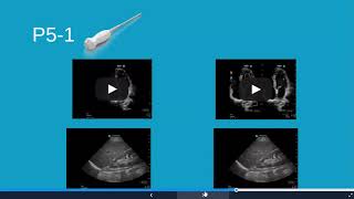 Sonosite PX: Designed for the Emergency Environment