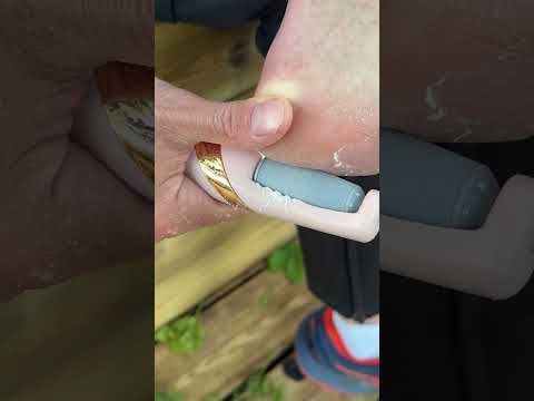 I Tried That Electric Callus Remover 😳💨🦶 | Dead Skin Everywhere!?