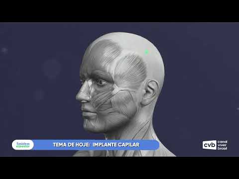 Saúde e Bem Estar - Implante Capilar (Bloco 1)