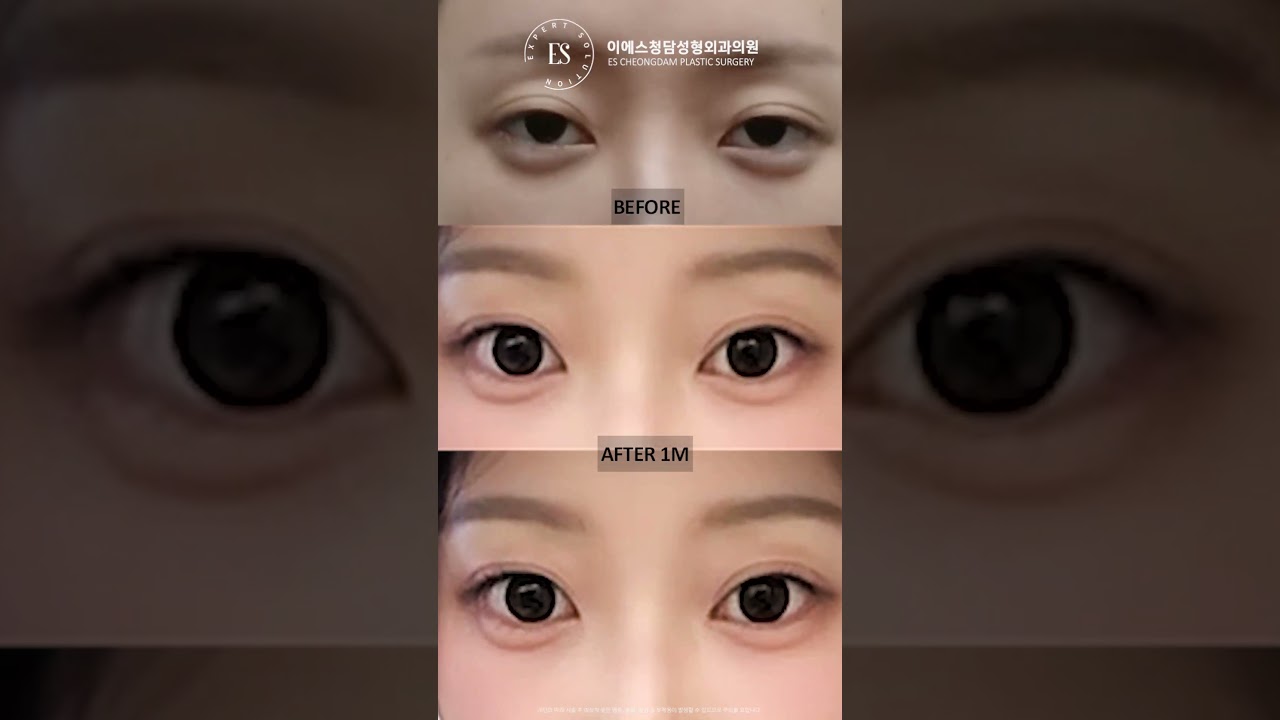 이에스 유튜브
