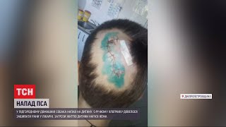 Под Днепром овчарка набросилась и искусала пятилетнего ребенка. Видео