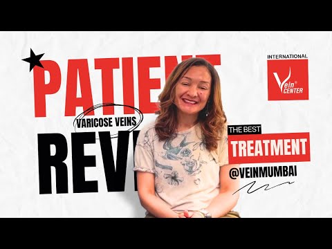 Patient from USA Review At The Vein Center | LASER vs VenaSeal