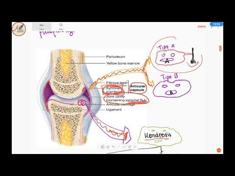 Arthrosis chondrosis kezelés