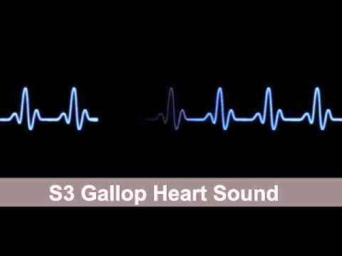 S3 Gallop   Heart Sound Collection For Auscultation Skills
