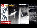 OLTKORE S T 2001 Full Album By Aan Hell Darkness