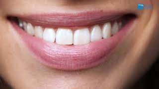 Sonrisa sana y perfecta con la ortodoncia invisible