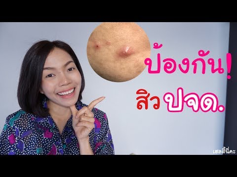 ความแตกต่าง seborrhea จากโรคสะเก็ดเงิน รักษากลากบนข้อศอกของฉัน