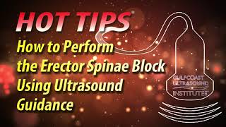 How to Perform the Erector Spinae Block Using Ultrasound Guidance