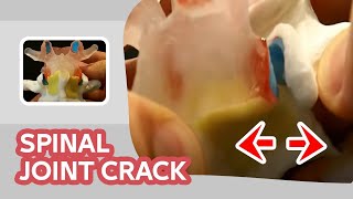 Spinal Joint Crack - (Back Cracking SOUND Explained)