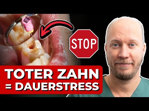 Wurzelbehandlung: Warum ich es NICHT mehr mache als Zahnarzt