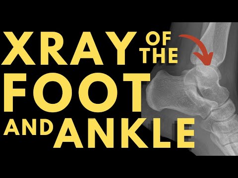 Bones of the Foot and Ankle | Radiology anatomy part 1 prep | Foot and ankle anatomy | X-ray