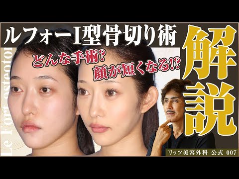 リダイレクトアイコン