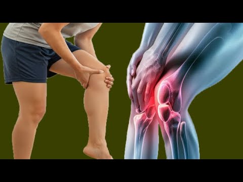 The Surprising Cause Of Most Knee Pain When Bending