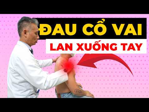 Đau cổ vai lan xuống tay – Điều trị thế nào?