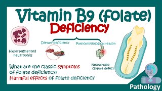 Folate deficiency | What are the symptoms of low folic acid? | Harmful effects of Folate deficiency