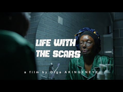 LIFE WITH SCARS by  Olga AKINGENEYE (Full Story PART 1)