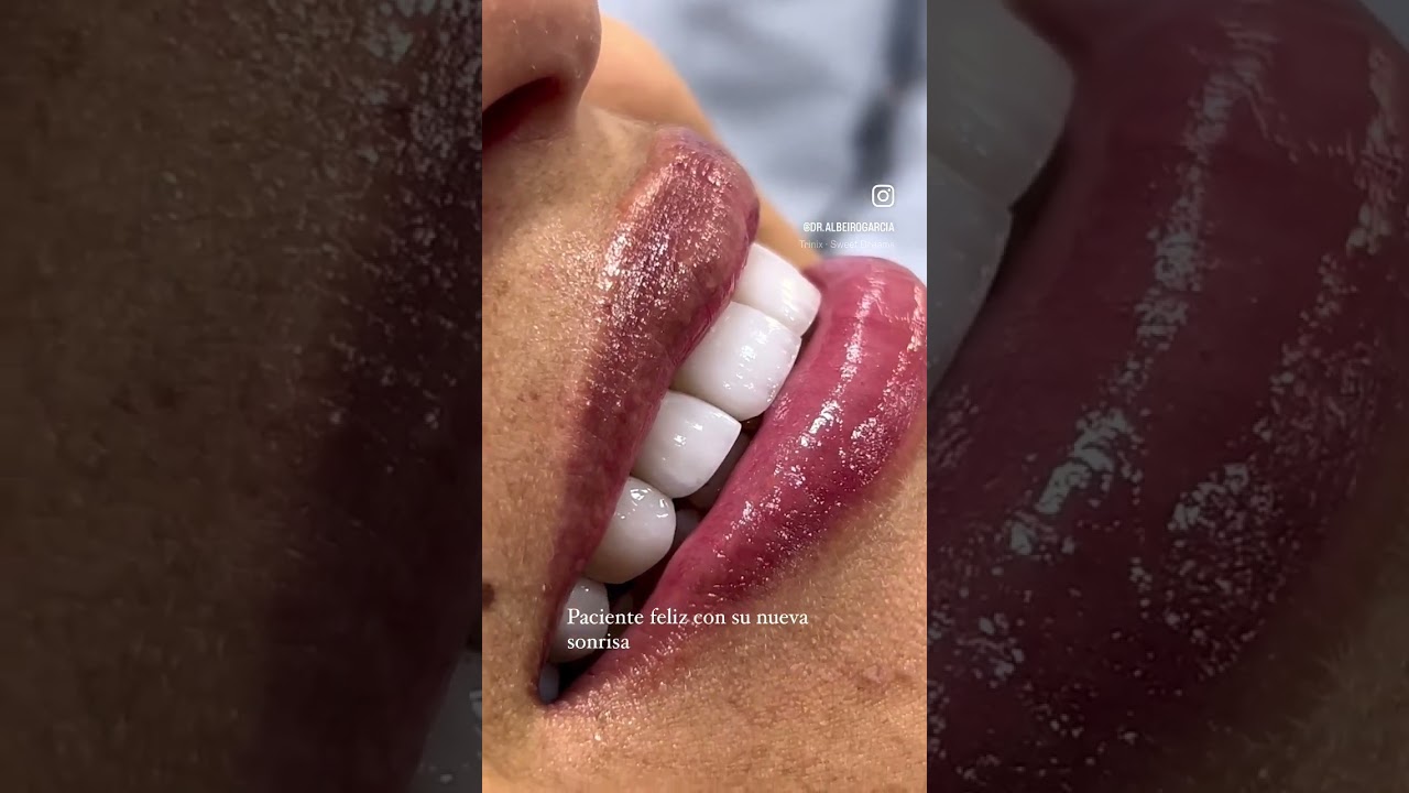 Albeiro García Varela-13