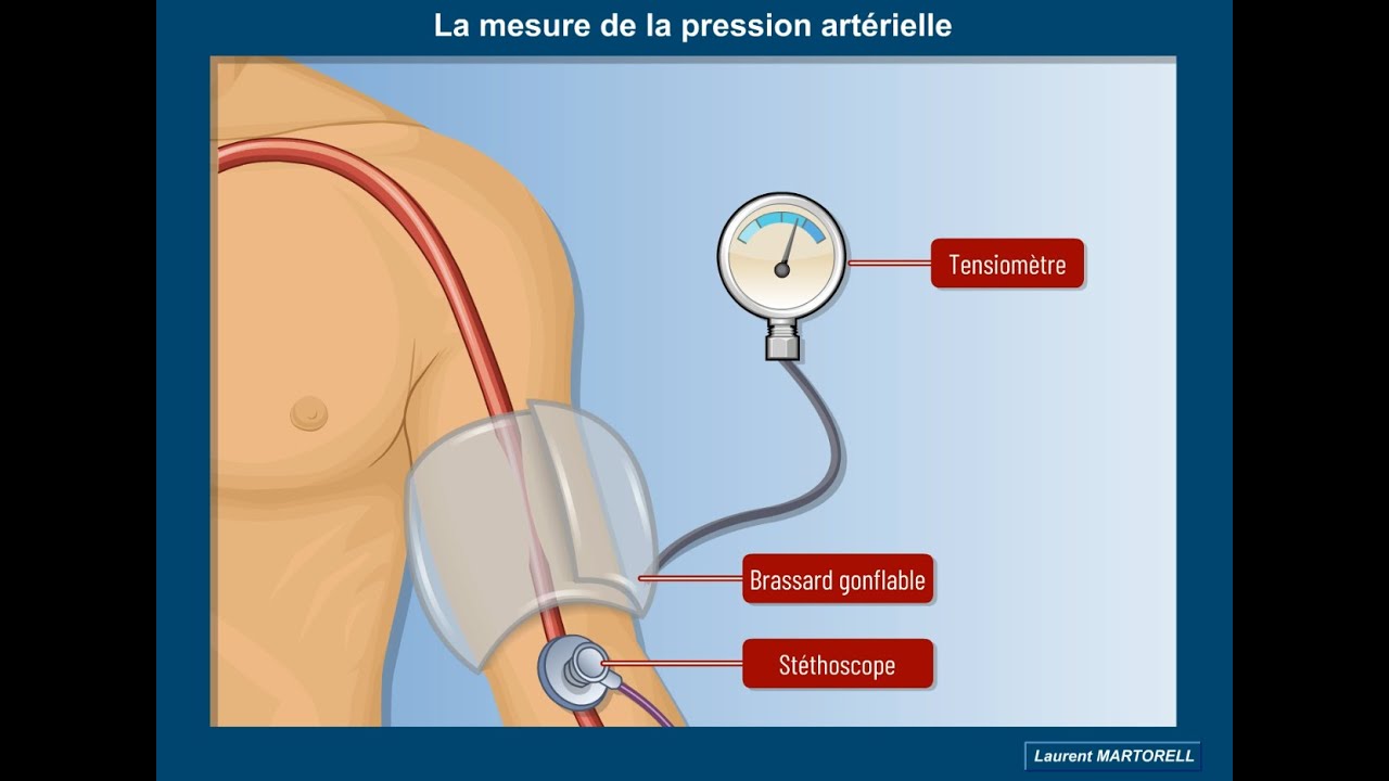 Quel est le principe de la mesure de la pression artérielle?