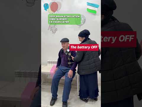 Watch how Deep Brain Stimulation (DBS) transforms a male patient's life!