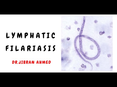 OSTEOGENIC TX II FLETCHERS 5TH E II ROBBINS 10TH E II POST GRADUATE LEARNING II DrJIBRANAHMED