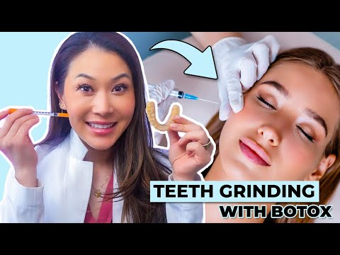 All About Treating Teeth Grinding (BRUXISIM) with Botox