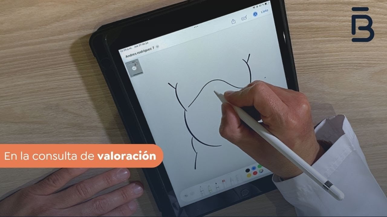 Consulta de Valoración Pre-Cirugía: ¿Cómo Funciona la Manga Gástrica