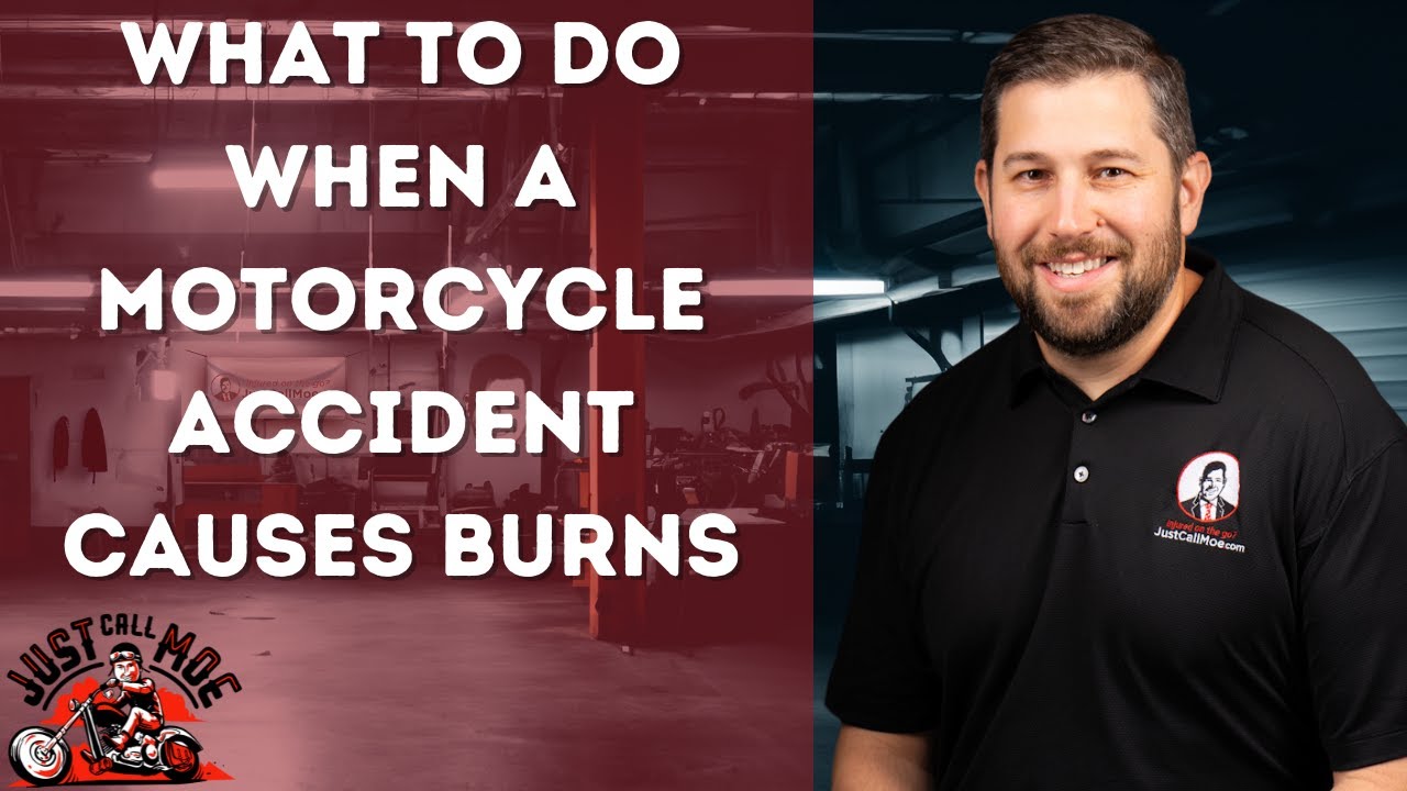 What should I do when a motorcycle accident causes burns?