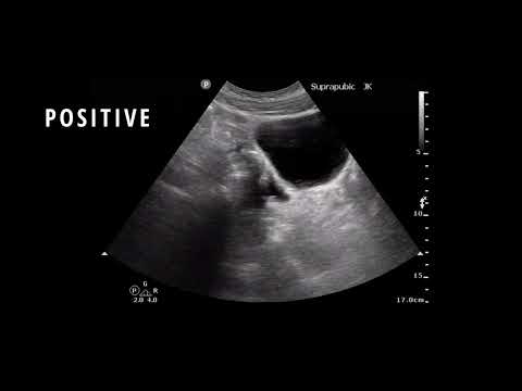 eFAST and RUSH Ultrasound