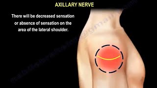 axillary nerve injury, causes, symptoms, diagnosis  and treatment. deltoid muscle weakness.
