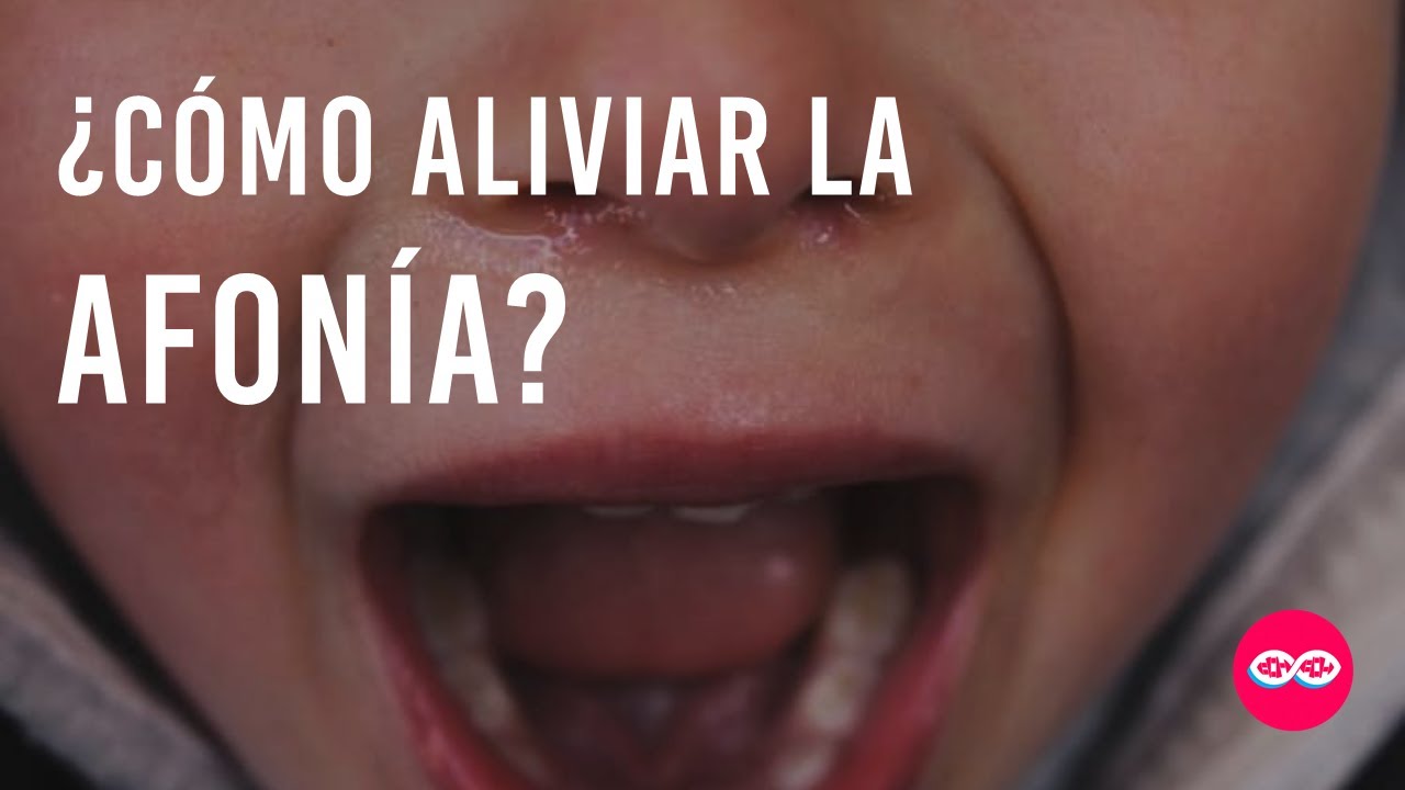 Remedio para la #Afonía Aguda | Sin Récipe