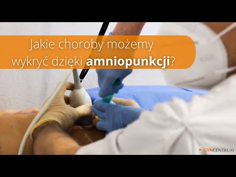 Badania prenatalne #11 - Amniopunkcja a wykrycie chorób u dziecka