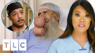 Dr. Lee &amp; Specialists Finally Remove Roger&#39;s Enormous Rynophyma! | Dr. Pimple Popper