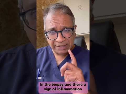 Uterine infection: Endometritis may hold key in failed ivf cycles