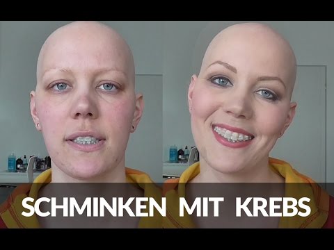 Schmerzen Übelkeit Impressionsfraktur des Kniegelenks